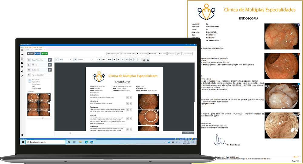 Sistema de laudos Zscan EVO